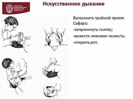 3 искусственное дыхание