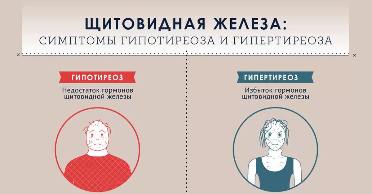 Симптомы гормоны щитовидной железы гипертиреоз. Гипотиреоз и гипертиреоз щитовидной железы. Гипертиреоз щитовидной железы симптомы. Симптомы гопотоериоза. Назови 3 недостатка