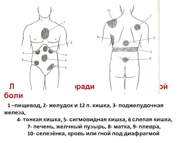 Иррадиация боли желудка. Иррадиация боли тонкого кишечника. Локализация и иррадиация боли.