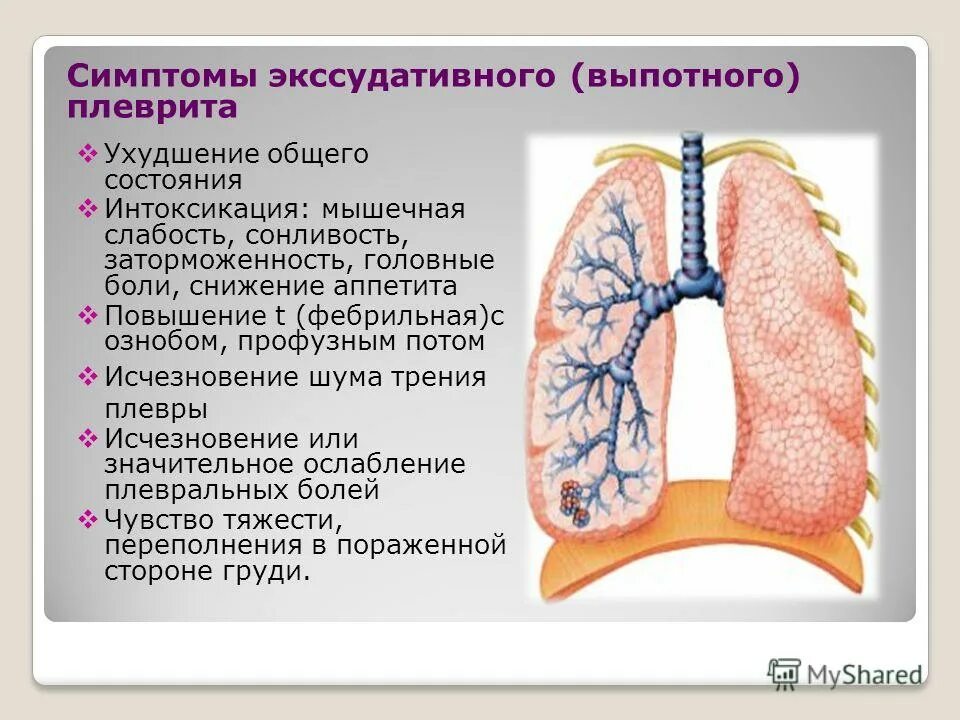 заболевание плевры легких. гнойный плеврит этиология. выпот плевральных листков. поражение плевры. заболевания плевры классификация.