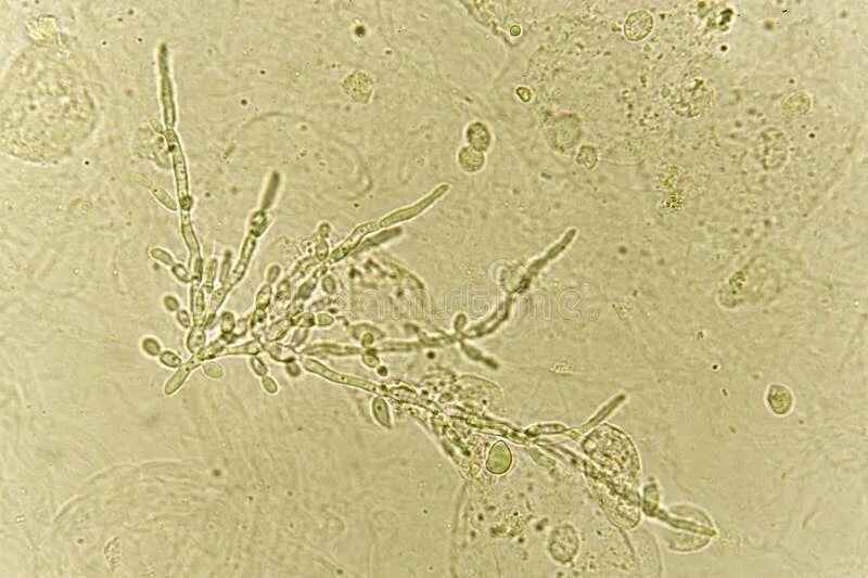 Мицелий грибов в моче микроскопия. Грибы кандида микроскопия. Грибы кандида лептотрикс. Мицелий грибов на коже