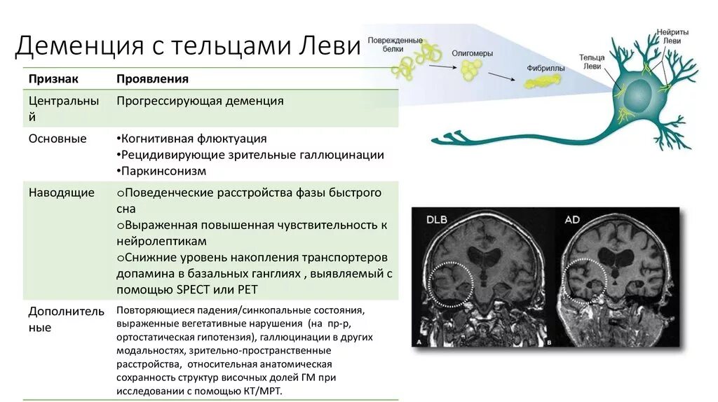 Канал деменция. Деменция с тельцами Леви мрт. Деменция с тельцами Леви дифференциальный диагноз. Мрт при деменции с тельцами Леви. Болезнь диффузных Телец Леви.