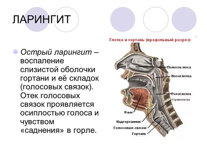 Чувствуешь как голосом. Заболевания глотки и гортани.