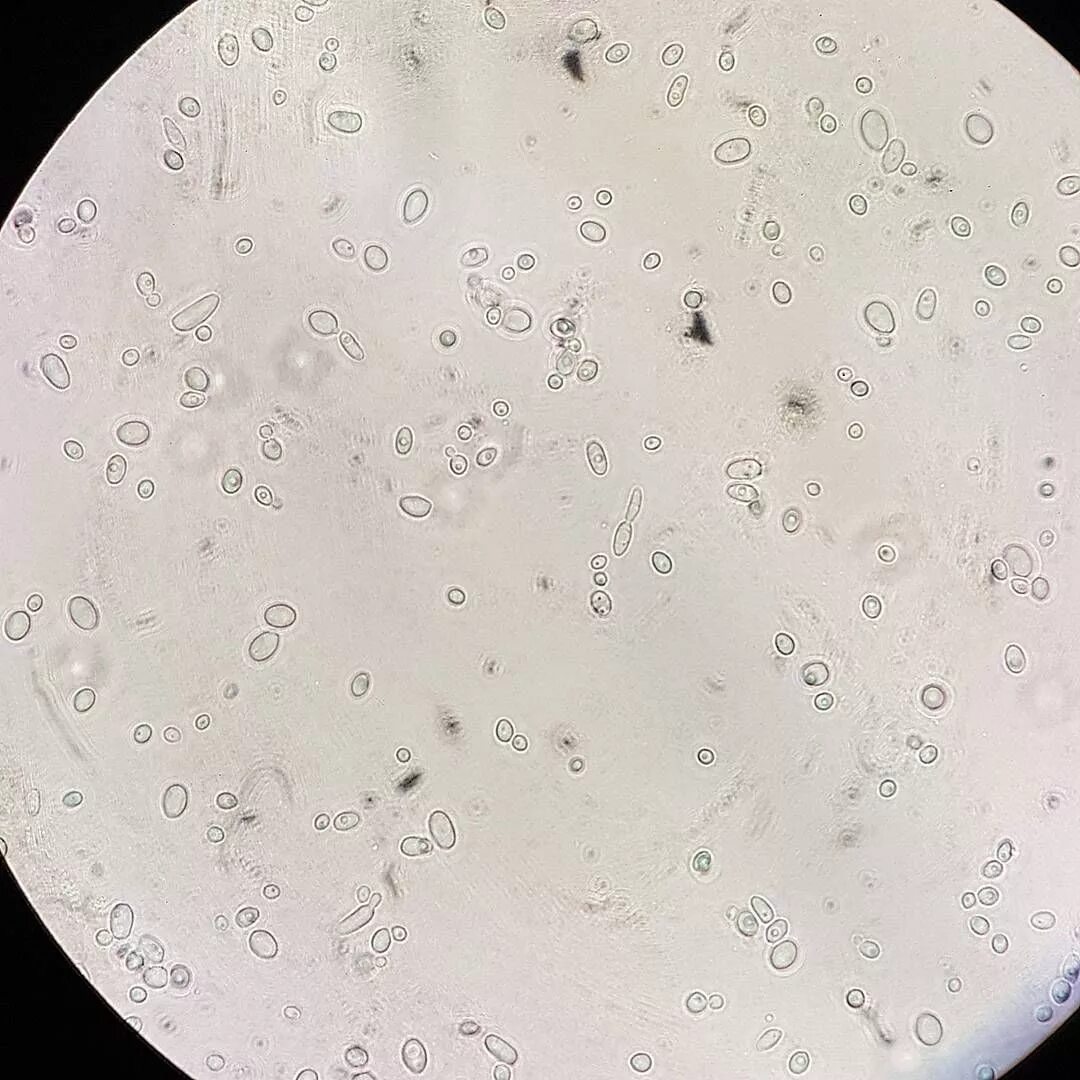 Candida parapsilosis микроскопия. Грибок кандида под микроскопом. Candida parapsilosis под микроскопом. Грибы Candida под микроскопом.