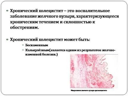 Холецистит это простыми словами у женщин хронический