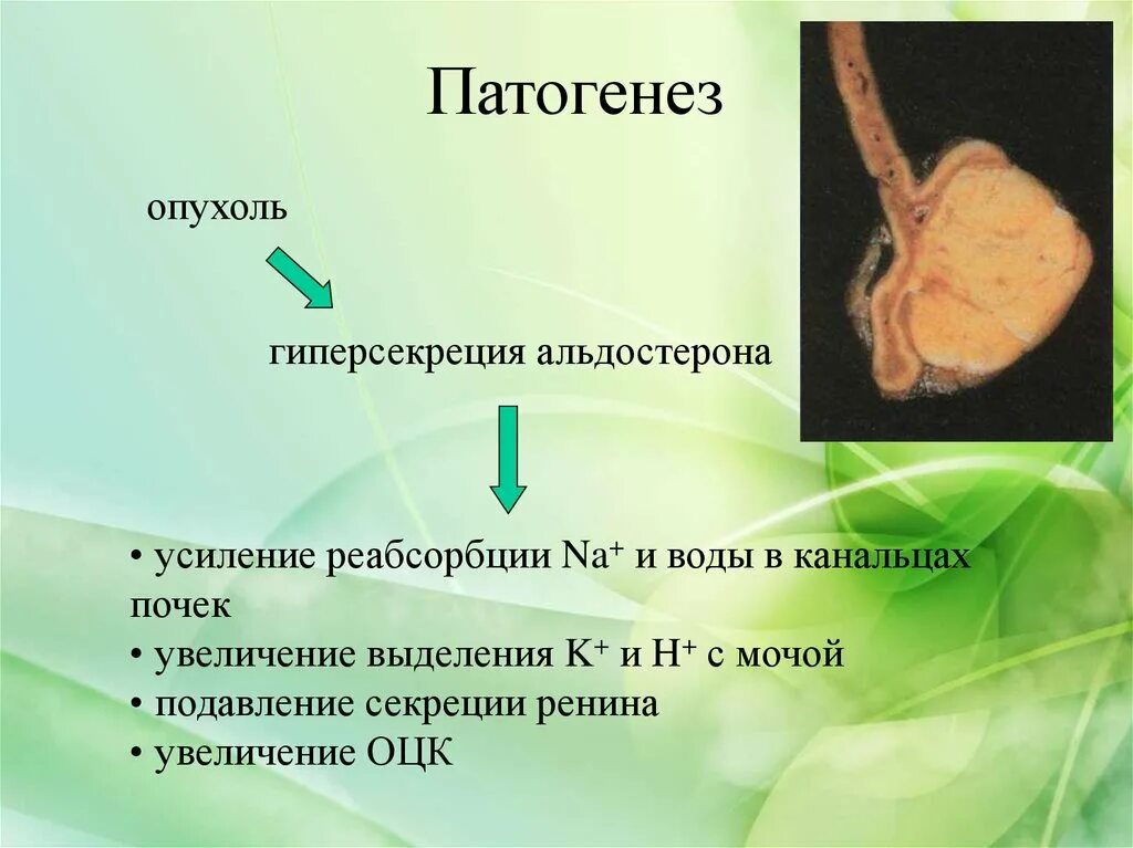 Опухоли почек этиология. Патогенез опухолей. Механизм развития опухоли. Патогенез опухоли почки. Патогенез почки