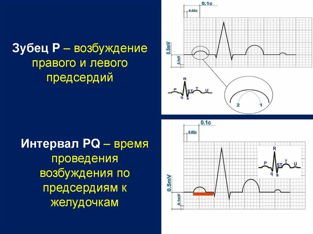 Амплитуда зубца s. Зубец отражает возбуждение. Зубец s отражает возбуждение. Зубец r отражает возбуждение. Зубец р отражает распространение возбуждения по.