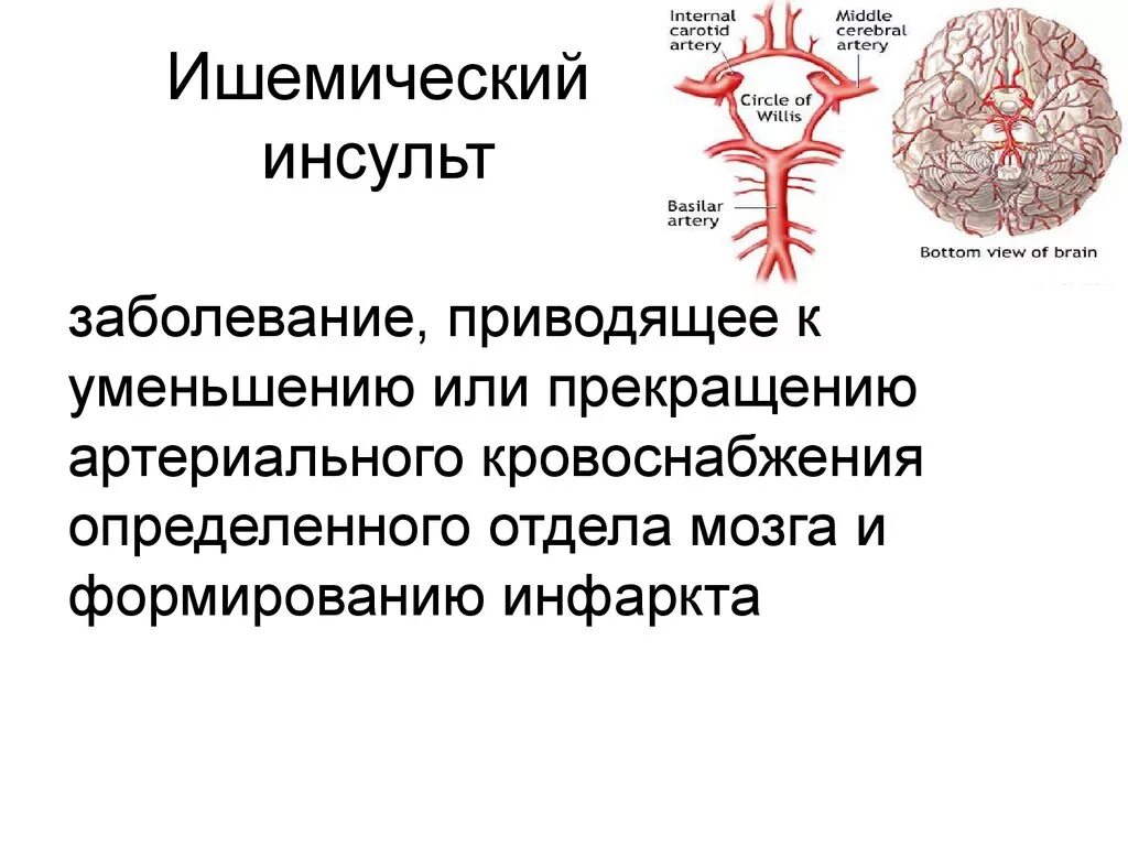 Поражения головного мозга при ишемическом инсульта. Локализация ишемического инсульта. Мришемического и нсульта. Инсульт и ишемический инсульт.