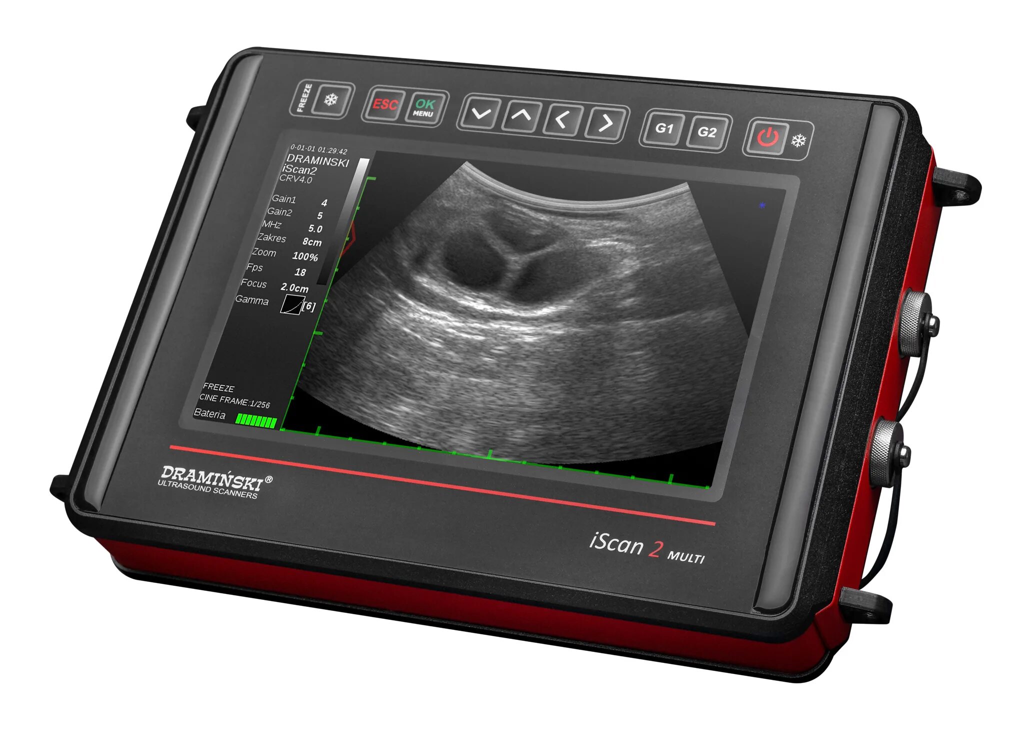 Scan multi. Узи сканер draminski iscan 2. ультрасонография узи-сканер iscan 2 multi - портативный ветеринарный. узи сканер драмински для крс. ветеринарный узи аппарат драмински.