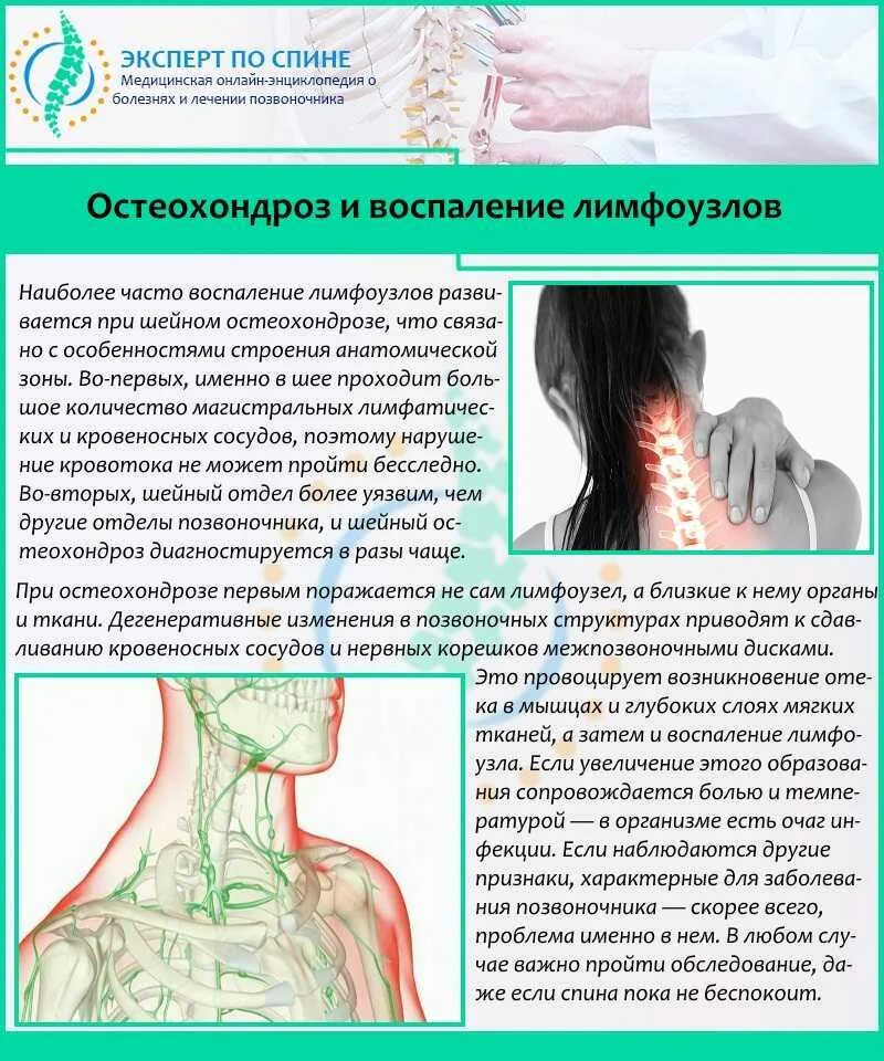 Воспаление шейного лимфоузла. Шейный остеохондроз болит голова что делать