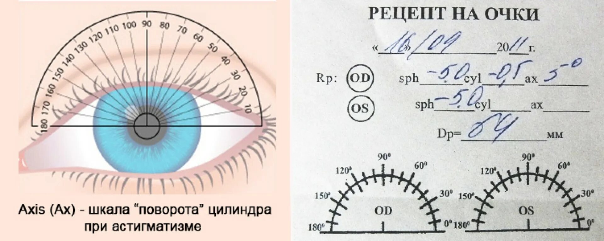 Астигматизм ось цилиндра. Линзы для глаз для зрения астигматизм. ось глаза при астигматизме. сложный миопический астигматизм очки. цилиндрическая линза астигматизм.