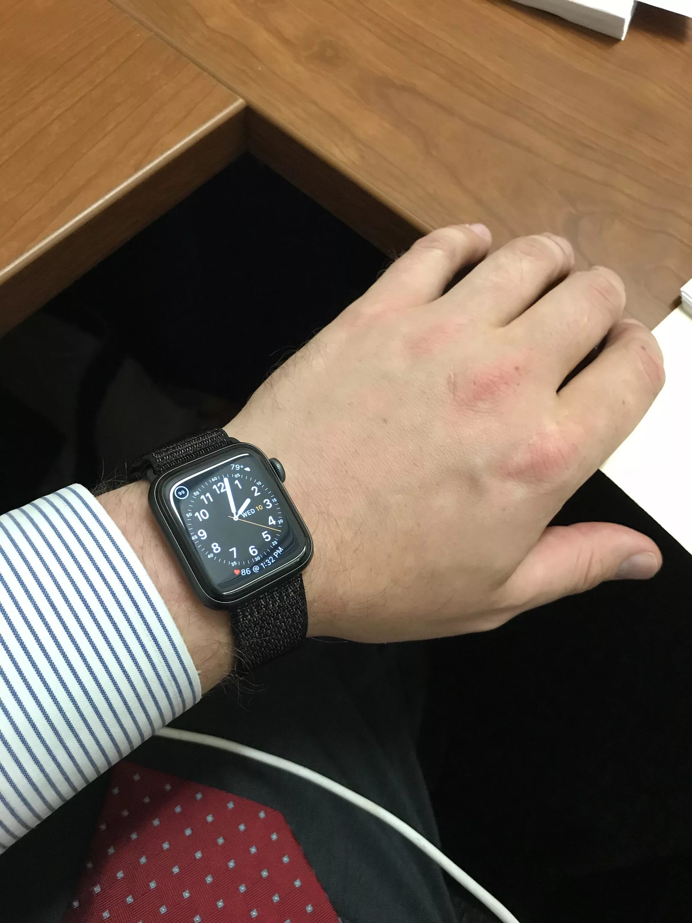 6 41 мм. Apple watch se 40mm. Часы эпл вотч se 40 мм. Эпл вотч se 44 мм. Apple watch 40mm vs 44mm.