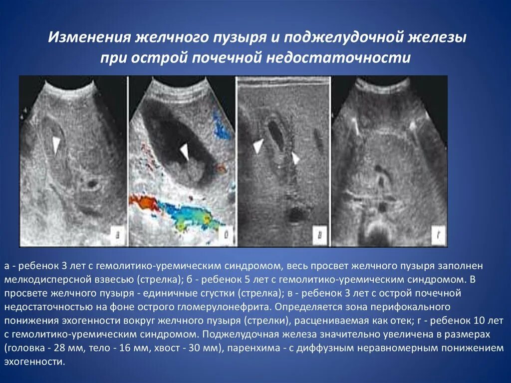 Желчный пузырь гомогенное что значит