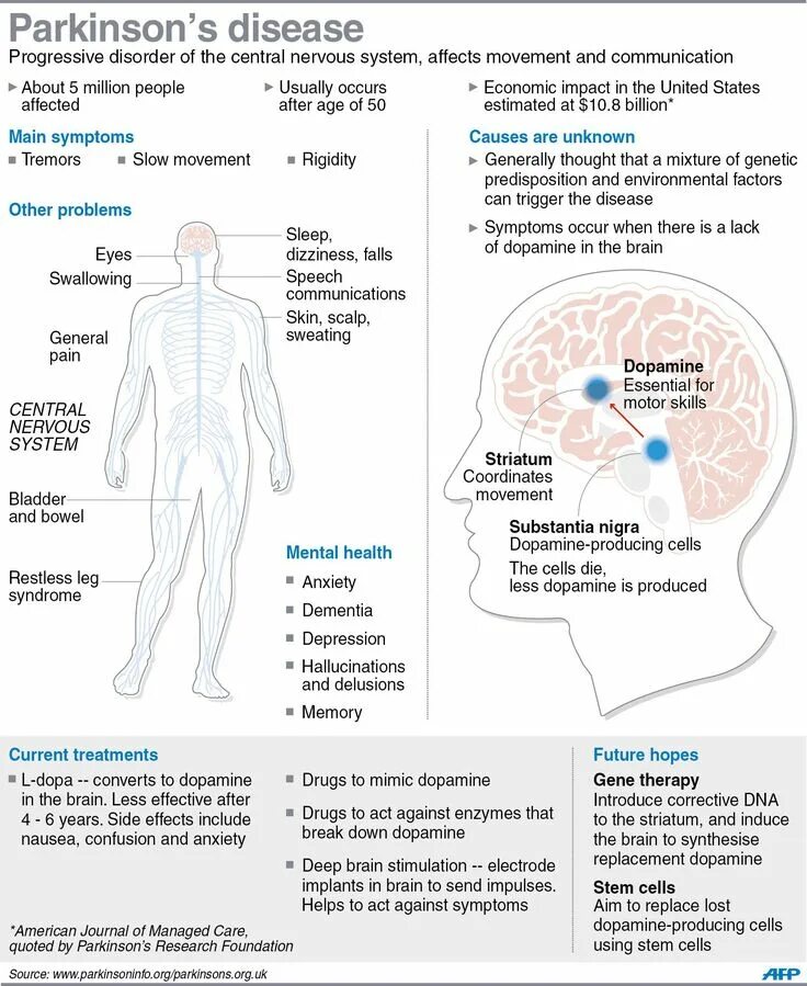 S disease. S disease. Симптомы гипонатриемии. Parkinson disease. Болезнь паркинсона.