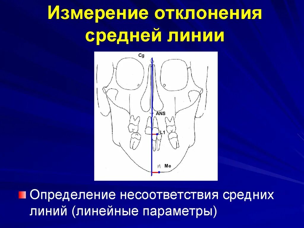 Ортопантомограмма перекрестный прикус. Отклонение языка от средней линии. Узи лобкового симфиза. Девиация по средней линии. Перекрестный прикус сужение верхней челюсти.