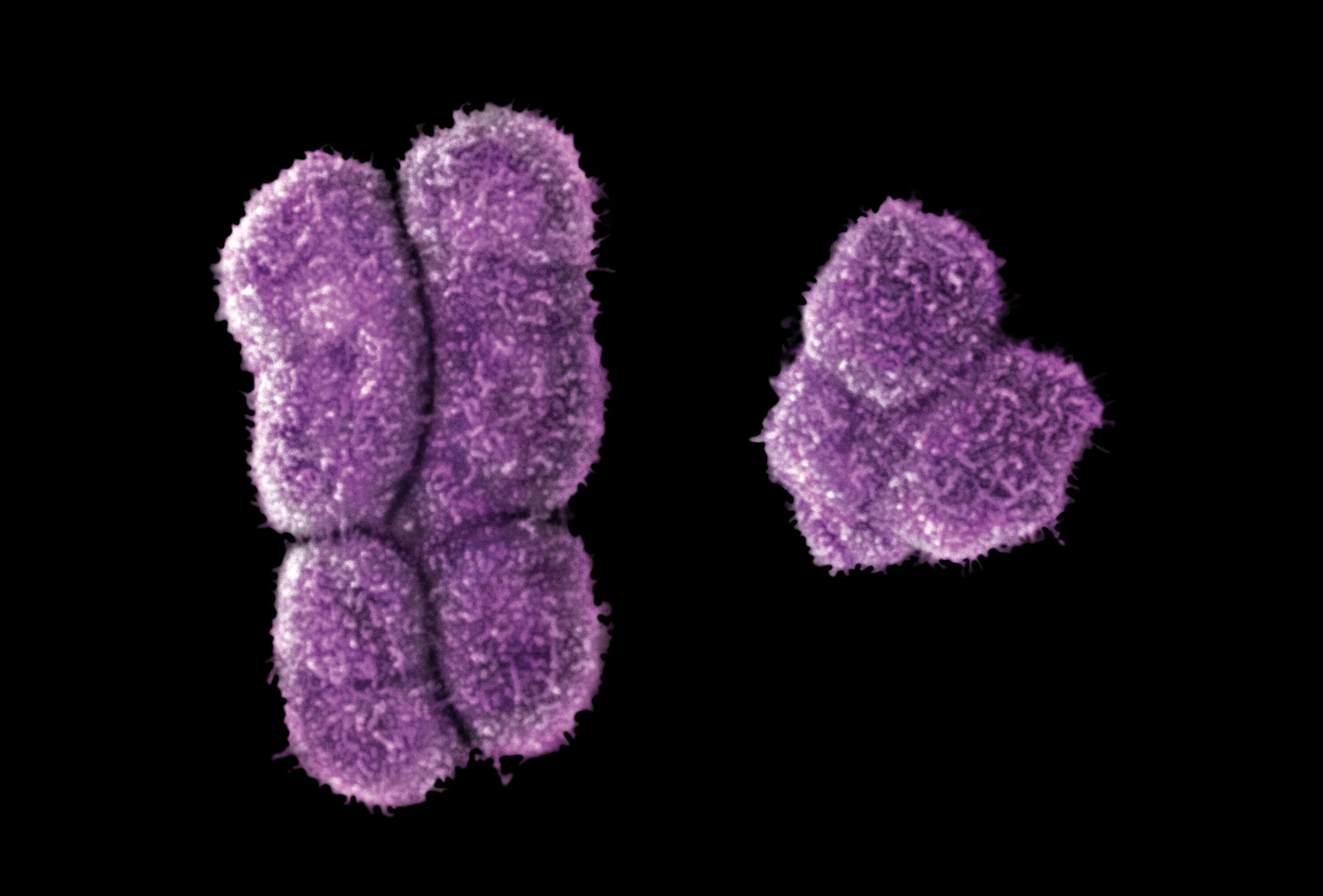 Вторая х хромосома. Игрек хромосома. XY хромосомы. Мужские половые хромосомы. Y хромосома.