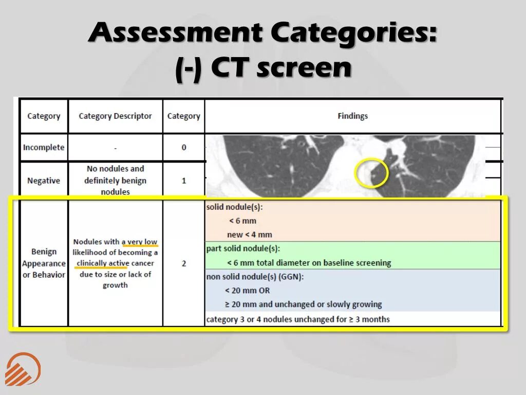 Lung rads классификация. Очаги по lung rads. Lung rads 2 классификация. 2 Категория по lung-rads. Категория o rads слева 1