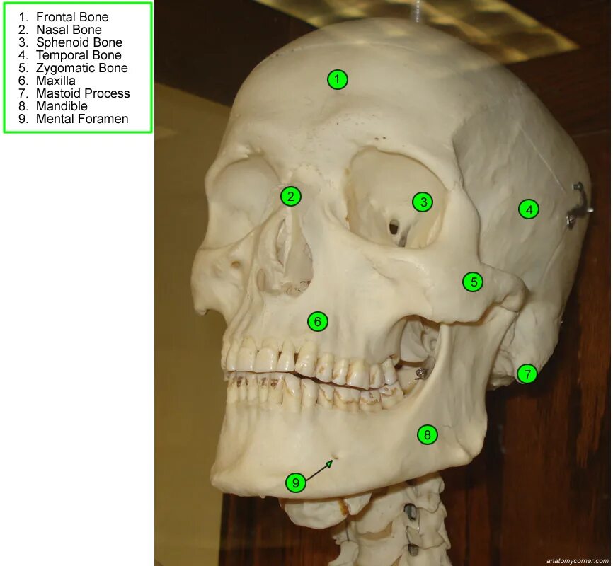 Большие лобные кости. Череп frontal Bone Anatomy. Foramen zygomaticotemporale на черепе.