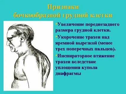 Признаки грудной клетки