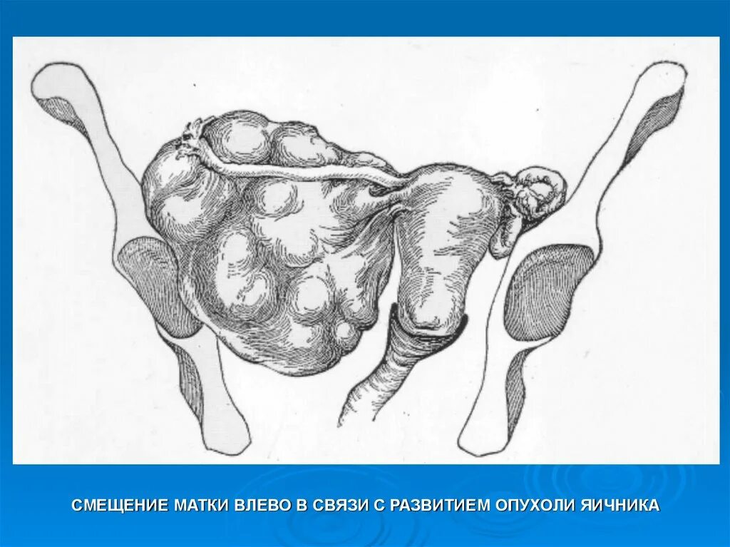 Матка в каком месте