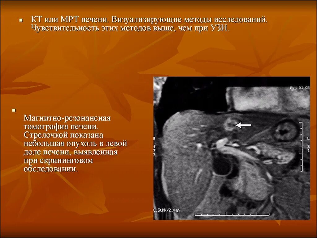 Магнитно-резонансная томография печени. Компьютерная томография печен. Кт норма печень