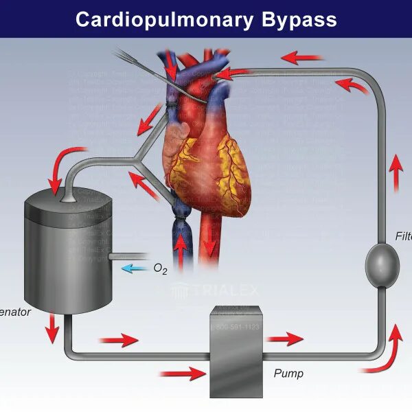 Frp bypass. Vivo y11 frp bypass. Bypass android 12. Frp bypass. Механический байпас для ибп.