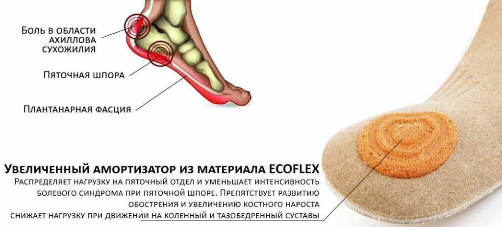 Шпоры причина появления. Стельки при пяточной шпоре и плоскостопии. Стельки от пяточной шпоры. Ортопедические стельки при пяточной шпоре.