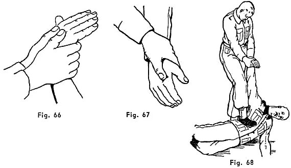 гимнастика для кистей рук при онемении. болевые приёмы на кисти рук. болевые приёмы на пальцы рук. приемы кисть. прием примакивание в рисовании.