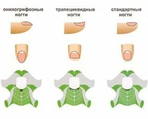 Как ставить форму. Как ставить форму