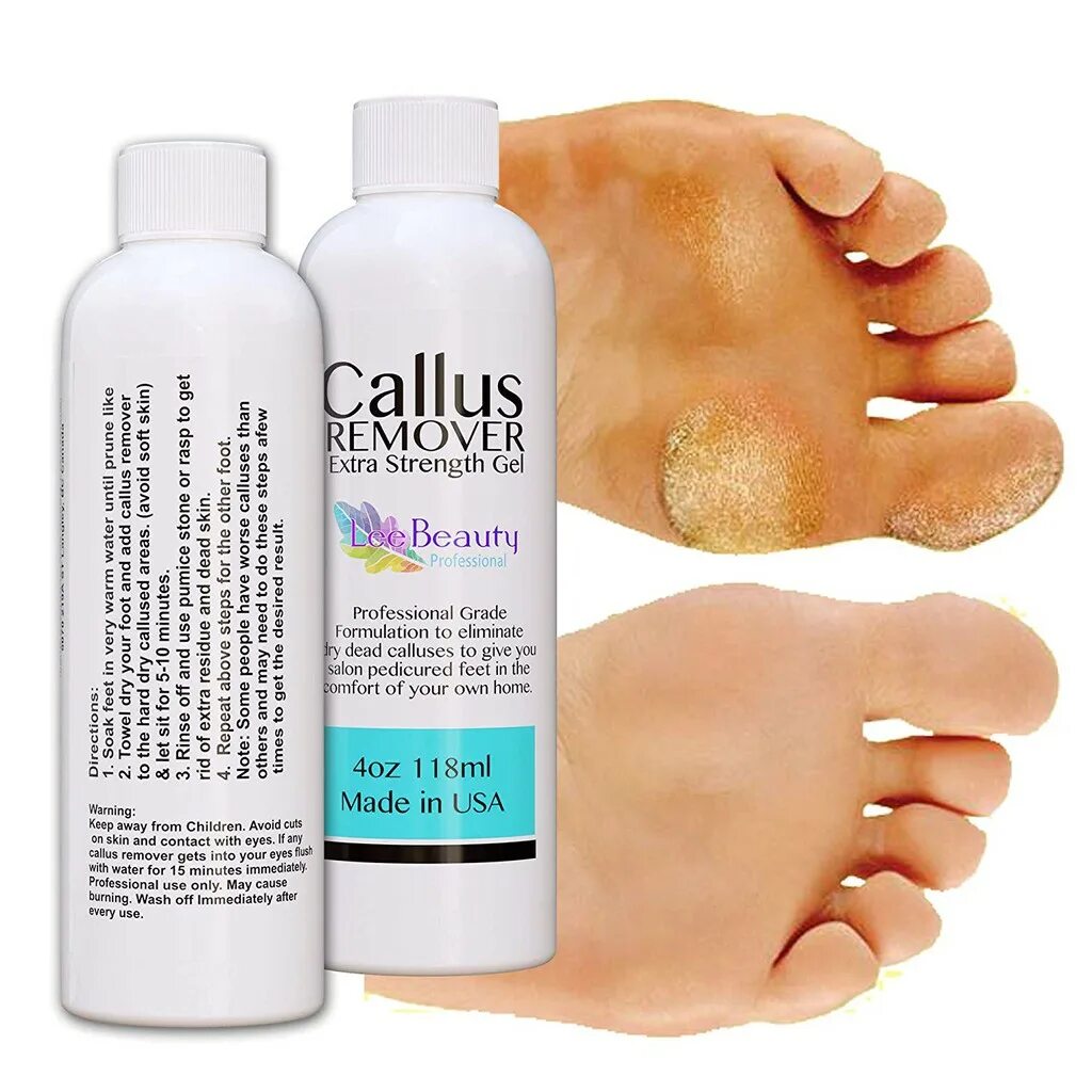 Callus remover. Гель Orly Callus Eraser 118 мл. Callus Care, 30 мл.. Callus professional капсулы.