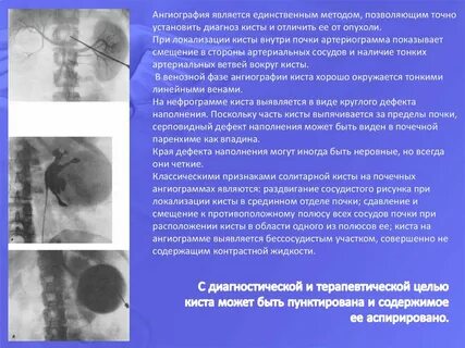 Размеры кист классификация
