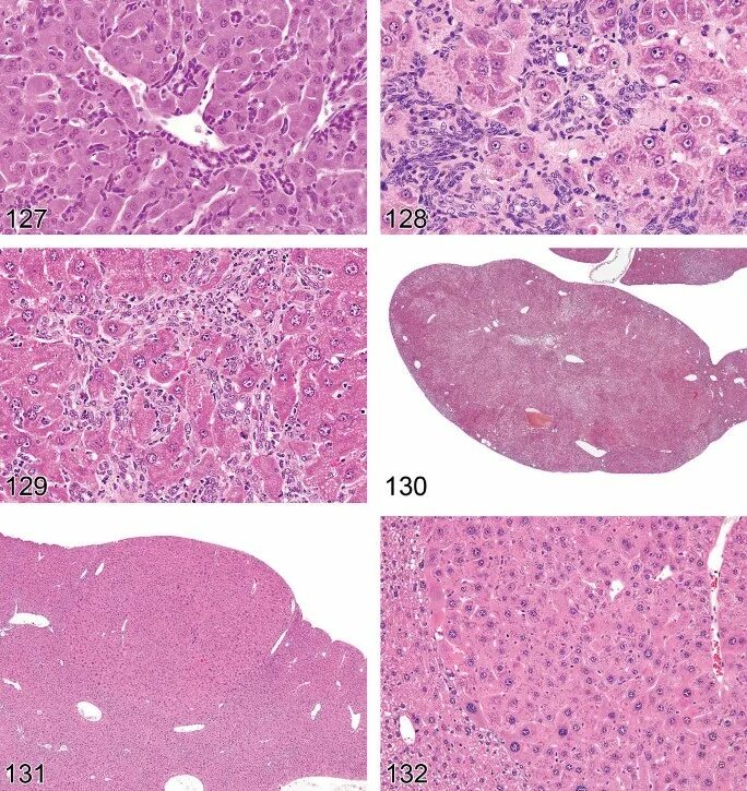 Клетки печени крыс. Печень крысы гистология. Печень крысы при холестазе гистология. Клетки печень акцолотки.