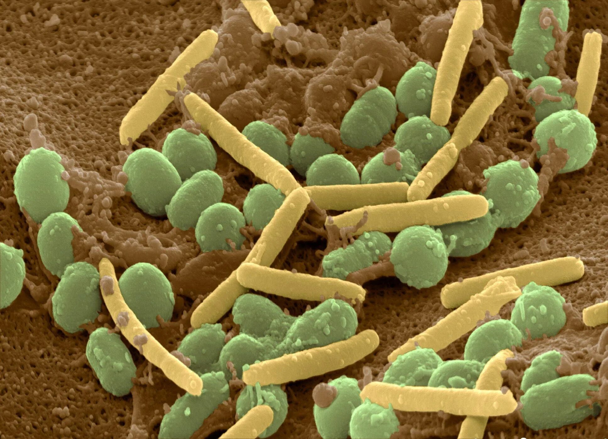 Почвенные бактерии это. Бактерии Myxococcus Xanthus. Почвенные микроорганизмы. Микроорганизмы в почве. Бактерии которые обитают в почве.