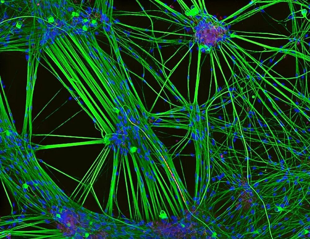 нейрон микрофотография. нейрон пуанкаре микрофотография. человеческий мозг под микроскопом. нервные клетки головного мозга под микроскопом. флуоресцентная микрофотография нейрона.