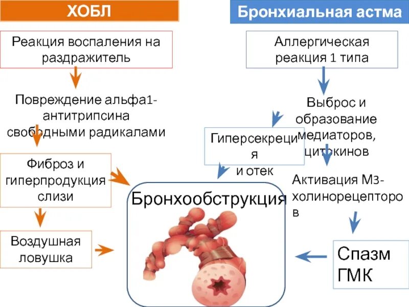 Как развивается астма