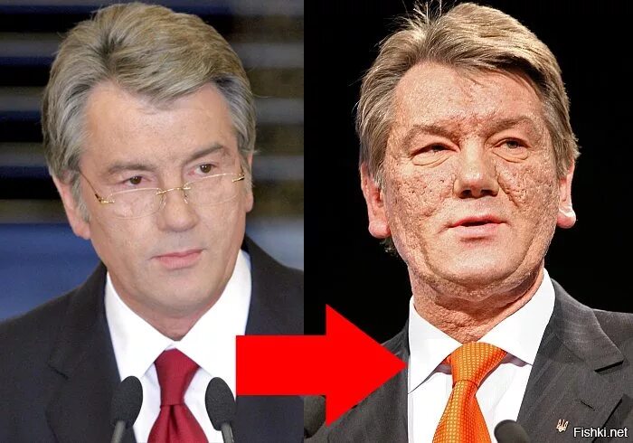 Ющенко что с лицом до и после ЕС может ввести новые санкции против Сирии после доклада о химатаках