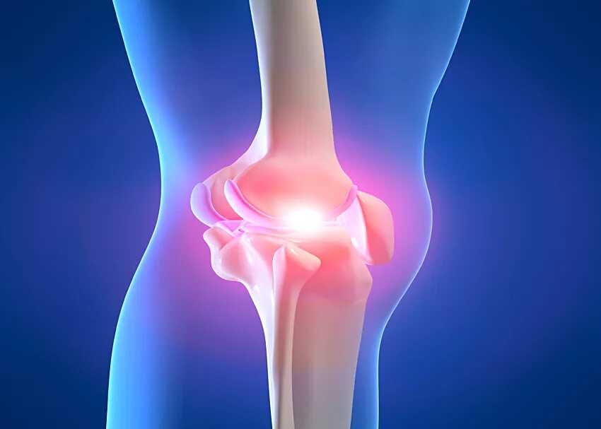 Артрит это. Пателлофеморальный артроз коленного сустава что это такое. Феморопателлярный артроз коленного сустава это. Артрозо-артрит коленного сустава. Гонартроз феморопателлярный пателлофеморальный.
