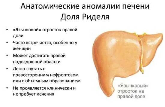 Симптомы увеличенной печени у взрослого. Аномалии развития печени на УЗИ.