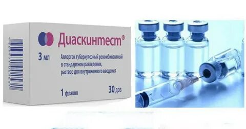 Диаскинтест проводят для выявления