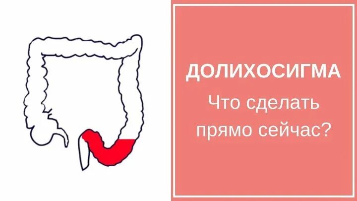 Долихосигма это. Долихосигма это. Долихоколон сигмовидной кишки. Сигмовидная кишка удлинена с петлеобразованием. Петля сигмовидной кишки петля.