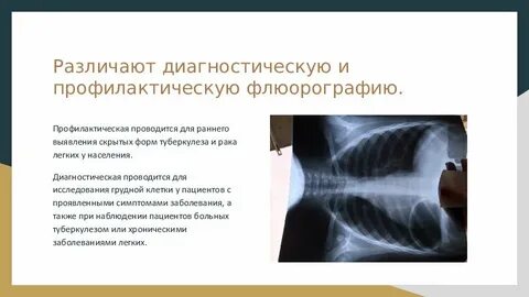 Флюорография 2 раза подряд