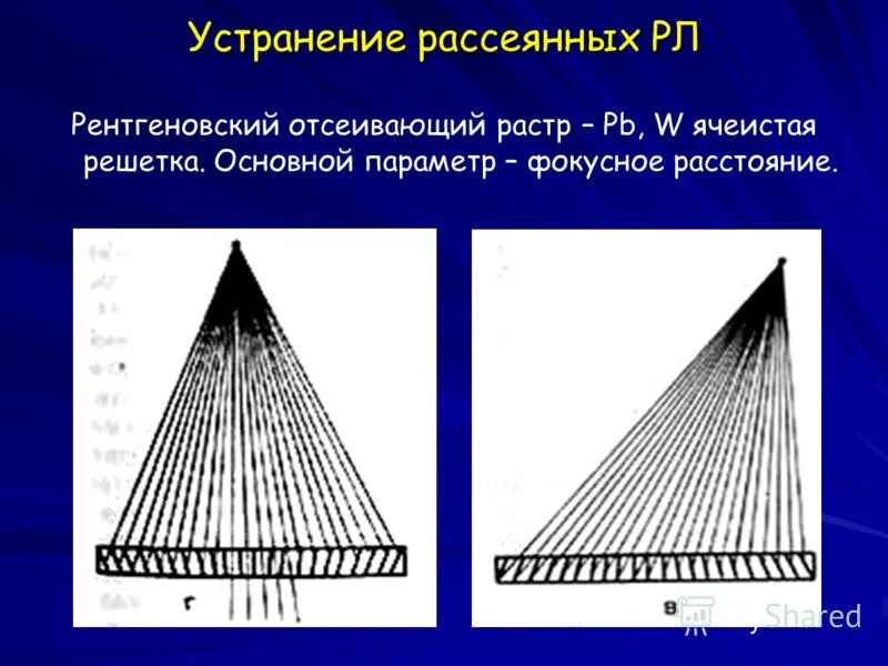 растр рентгеновский отсеивающий. растр рентгеновский отсеивающий. отсеивающий растр схема линий. отсеивающий растр. отсеивающий растр в рентгенологии.