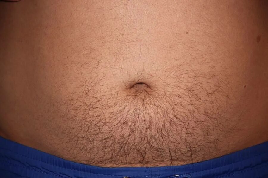 Почему у беременных растут волосы. Почему у женщин во время беременности растут волосы на животе. Отросшие волосы у беременной. Почему у беременных растут волосы. Отращивание волос до и после.