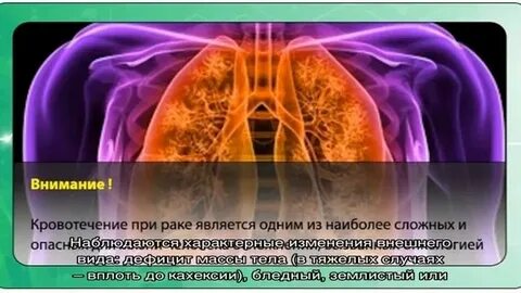 Раковая интоксикация сколько живут