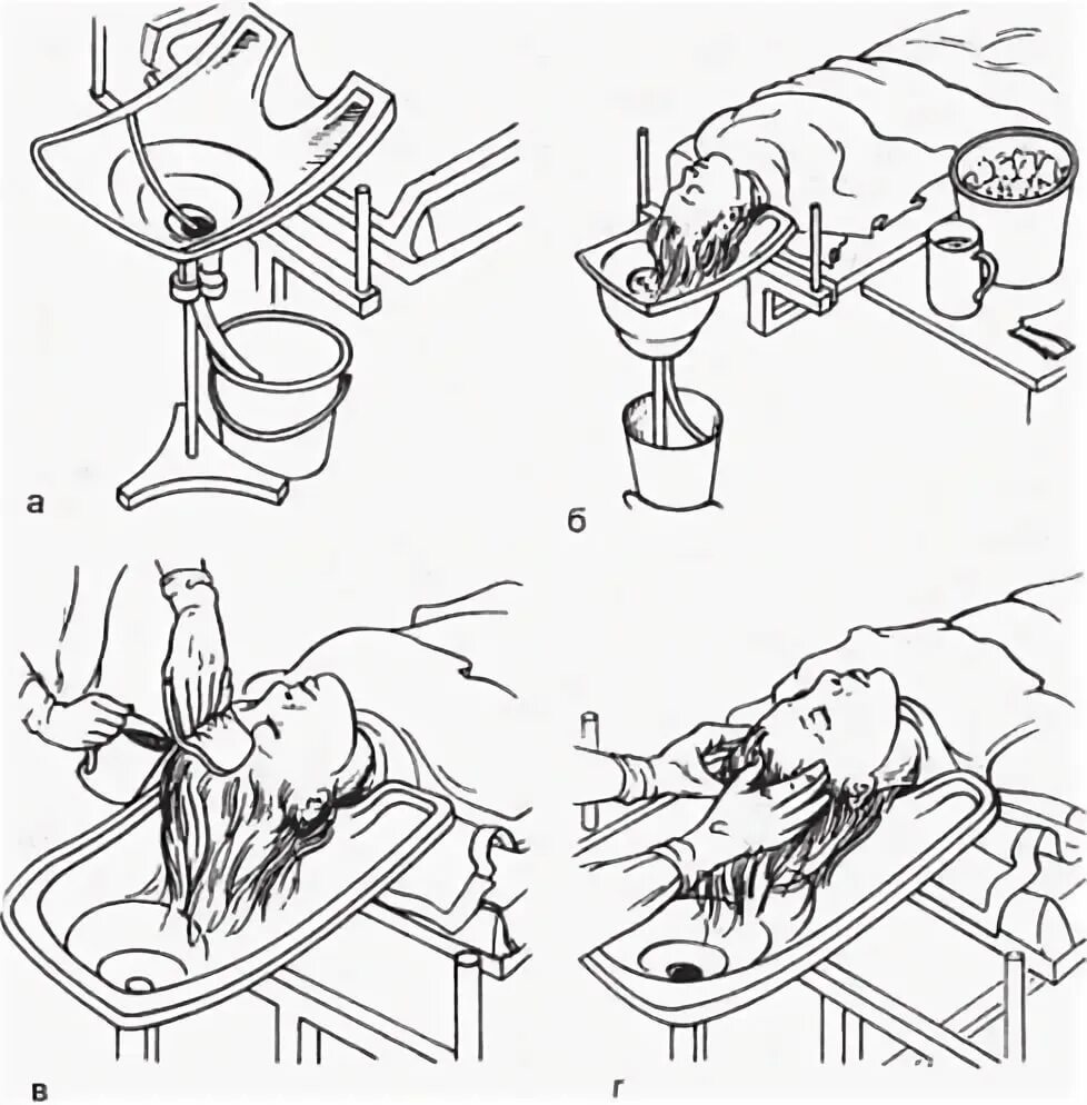 Мытье головы пациента. Мытье головы тяжелобольного пациента. Мытье головы тяжелобольного пациента алгоритм. Мытье головы алгоритм тяжелобольного. Мытье головы тяжелобольного пациента памятка.