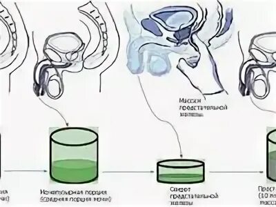 Как делать массаж простаты