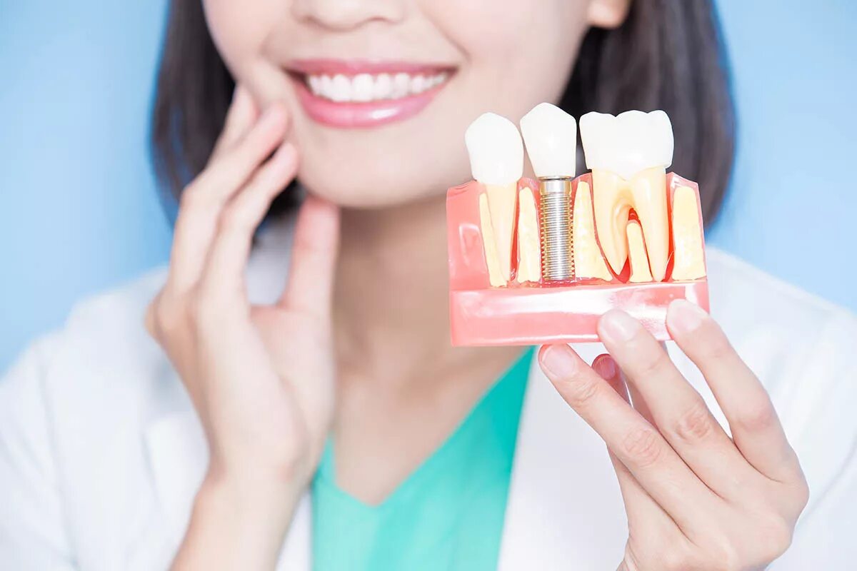 Dental implantation. Имплантация neodent. Dental implantation. Имплант зуба osstem. Neodent импланты.