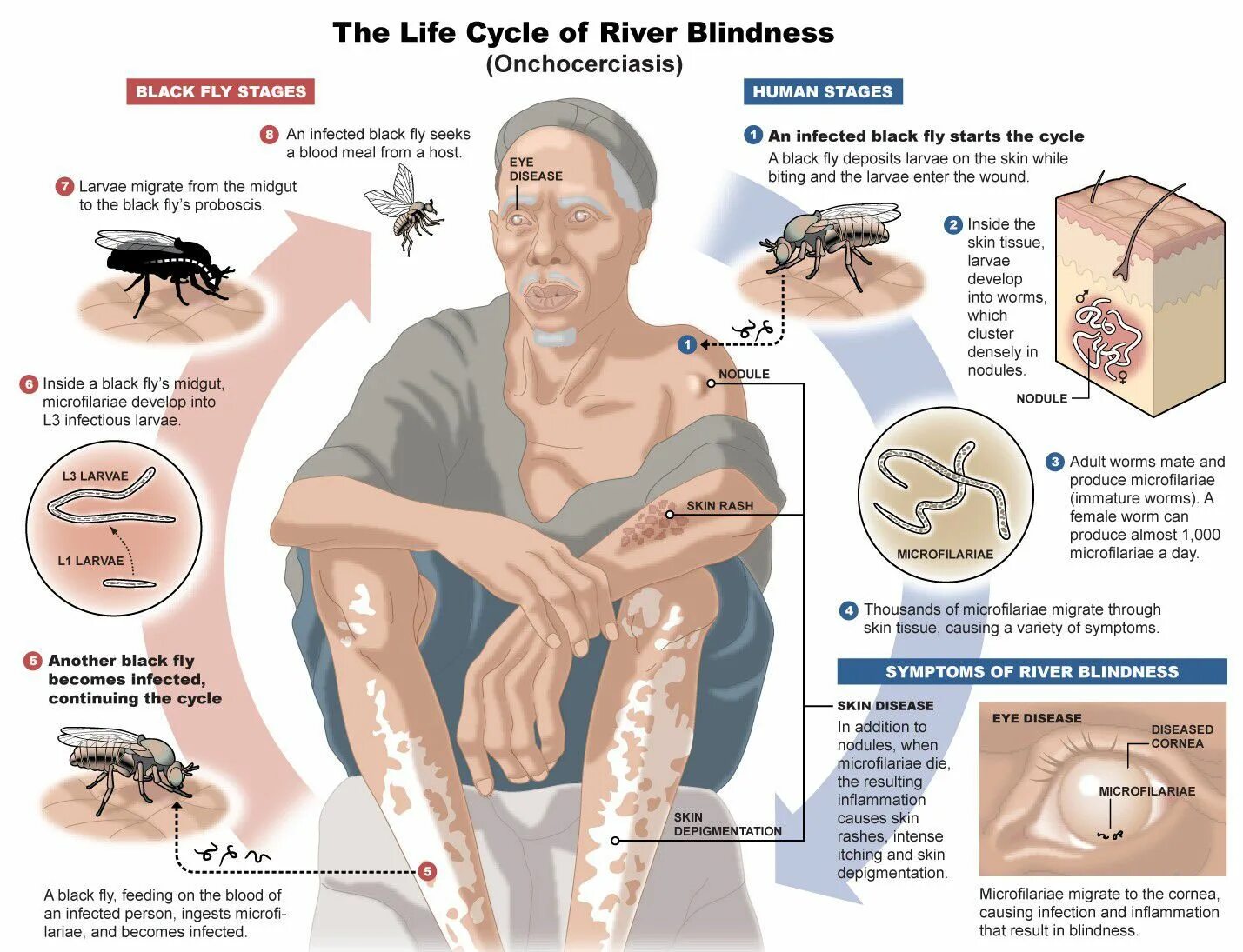Causing infection