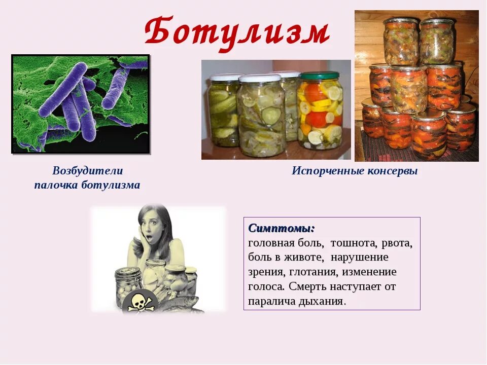 Чаще всего ботулизм связан с употреблением ответ. Пищевое отравление ботулизм возбудитель. Ботулизм пищевые токсикоинфекции. Возбудители ботулизма биология 8 класс. Отравление консервами ботулизм симптомы.