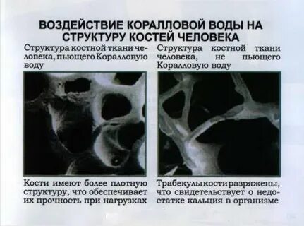 Вода в костях